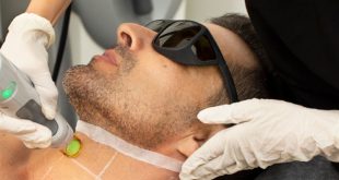 چطور از بازگشت موهای زائد بعد از لیزر جلوگیری کنیم؟ نکات مراقبتی پس از درمان