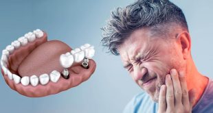 با خدمات ویژه و قیمت‌گذاری رقابتی در Morita Implant Center آشنا شوید