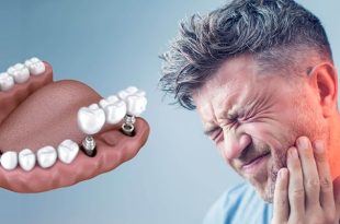 با خدمات ویژه و قیمت‌گذاری رقابتی در Morita Implant Center آشنا شوید