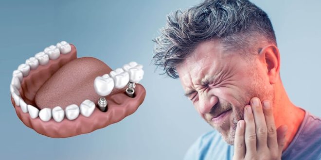 با خدمات ویژه و قیمت‌گذاری رقابتی در Morita Implant Center آشنا شوید