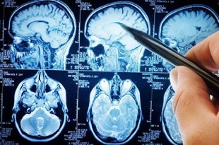 بهترین جراح مغز و اعصاب