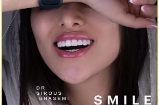 چجوری میتوانیم یک لبخند هالیوودی داشته باشیم؟