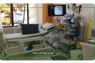 میزان کاهش وزن بعد از بوتاکس معده چقدر است؟