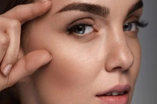 افتادگی پلک بعد از بوتاکس