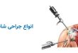 انواع جراحی شانه