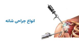 انواع جراحی شانه