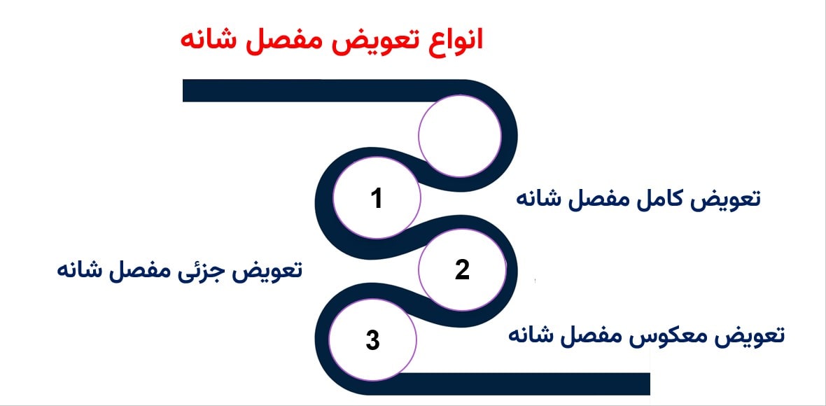انواع تعویض مفصل شانه