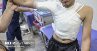 حادثه ای دردناک به نام «سوختگی» در ایران!