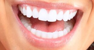 زیبایی لبخند بدون آسیب به دندان