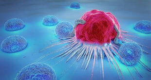 هامارتوما؛ توموری که سرطان نیست ولی همه را می‌ترساند!