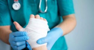 ۱۰۲ بیمار سوختگی در سیستان تحت درمان قرار گرفتند