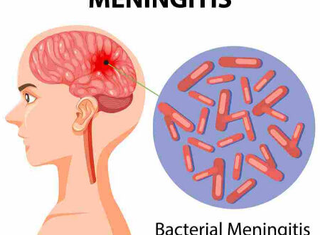 واکسن و بهداشت؛ کلیدهای طلایی برای پیشگیری از مننژیت
