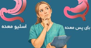 لاغری پایدار با روش های نوین جراحی؛ اسلیو معده یا بای پس معده کدام انتخاب بهتری است؟
