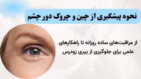 کرم دور چشم کرم دور چشم