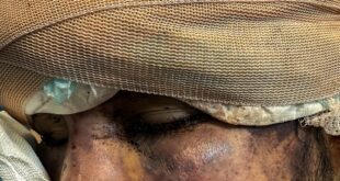 رد خون تروریسم روی «سلامت»؛ هدف از حمله به آمبولانس‌ها چیست؟