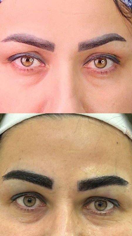 میکرو کاشت ابرو چیست؟ میکرو کاشت ابرو چیست؟