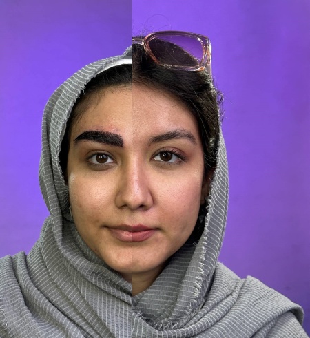 نتیجه نهایی کاشت ابرو نتیجه نهایی کاشت ابرو