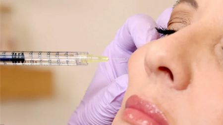 بهترین دکتر تزریق ژل در شیراز