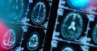 هشدار به بیماران صرعی و آسمی درباره قطع دارو در ایام روزه‌داری