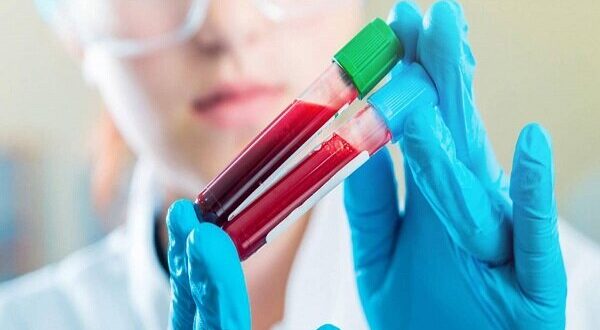 چقدر احتمال دارد مبتلا به سرطان شویم