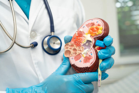 پیشگیری از نارسایی کلیه, سم زدایی کلیه