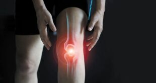 درمان آرتروز زانو