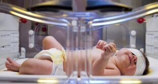 ارایه خدمات سلامتی نوزادان بدون وقفه در مراکز منتخب جامع سلامت