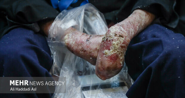 ارسال ۱۰۰۰ دارو و ۹۷۰ پانسمان بیماران پروانه ای