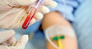 بیماری هموفیلی؛ از ابتلا تا پیشگیری