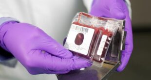 ذخیره سازی ۱۵۰۰ نمونه خون بندناف در جنگ رمضان