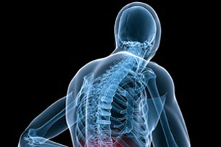 قوز کمر, پیشگیری از قوز کمر,درمان قوز کمر