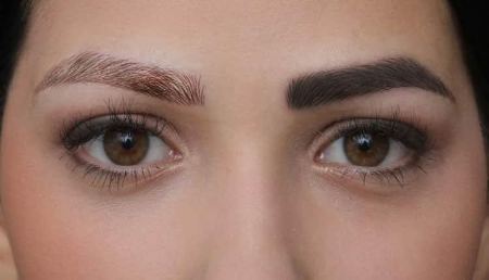 عوارض تاتو ابرو با لیزر