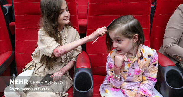 ۵۵ میلیارد تومان خدمات به بیماران پروانه‌ای ارائه شد