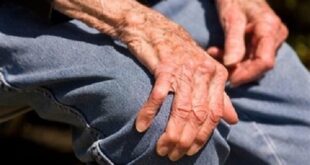 مشکل هورمون درمانی برای بیماران جراحی مفصل زانو