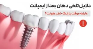 تلخی دهان بعد از ایمپلنت دندان؛ علت‌ها، علائم و راه‌های درمان