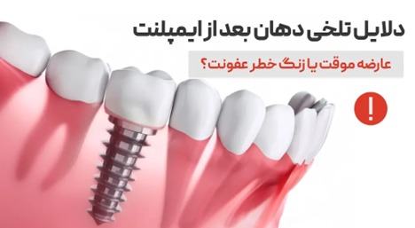تلخی دهان بعد از ایمپلنت دندان؛ علت‌ها، علائم و راه‌های درمان
