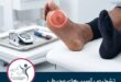 تشخیص آسیب‌های محیطی در بیماران دیابتی