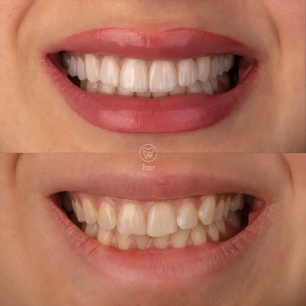 لمینت دکتر علیرضا صالحی