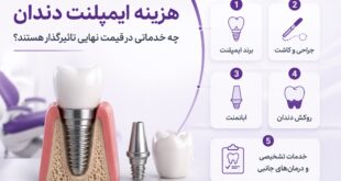 هزینه ایمپلنت دندان؛ چه خدماتی در قیمت نهایی تاثیرگذار هستند؟