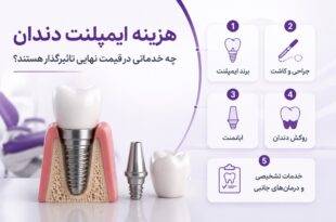هزینه ایمپلنت دندان؛ چه خدماتی در قیمت نهایی تاثیرگذار هستند؟