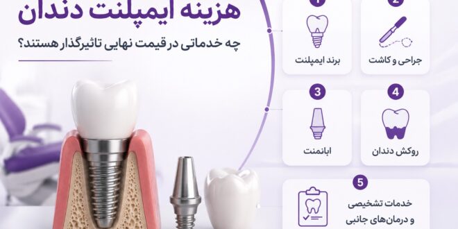 هزینه ایمپلنت دندان؛ چه خدماتی در قیمت نهایی تاثیرگذار هستند؟