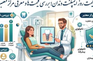 قیمت ایمپلنت دندان