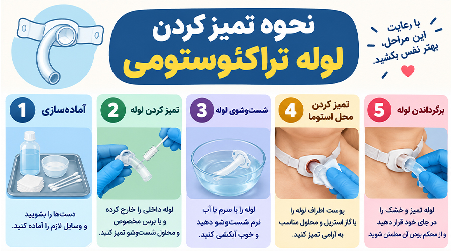 نحوه تمیز کردن لوله تراکئوستومی