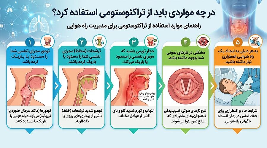 چه زمانی نیاز به لوله تراکئوستومی داریم؟